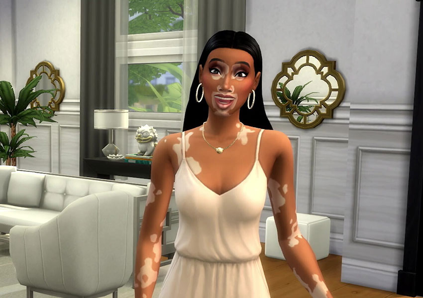 Los Sims 4 implementa la característica de piel de vitíligo en el videojuego